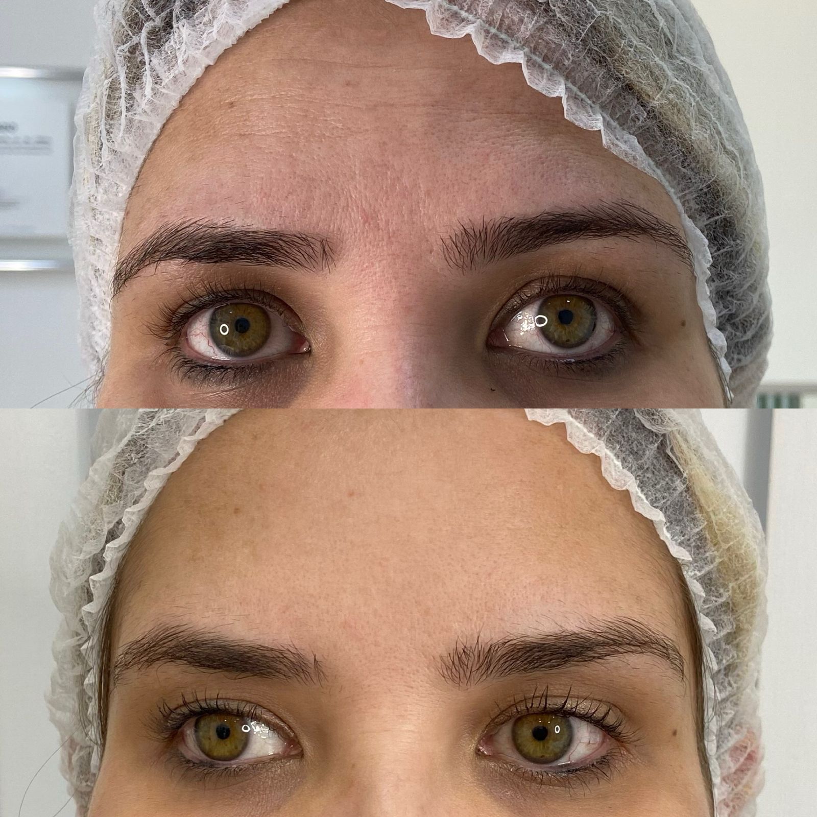 Antes e depois Bélla Natural