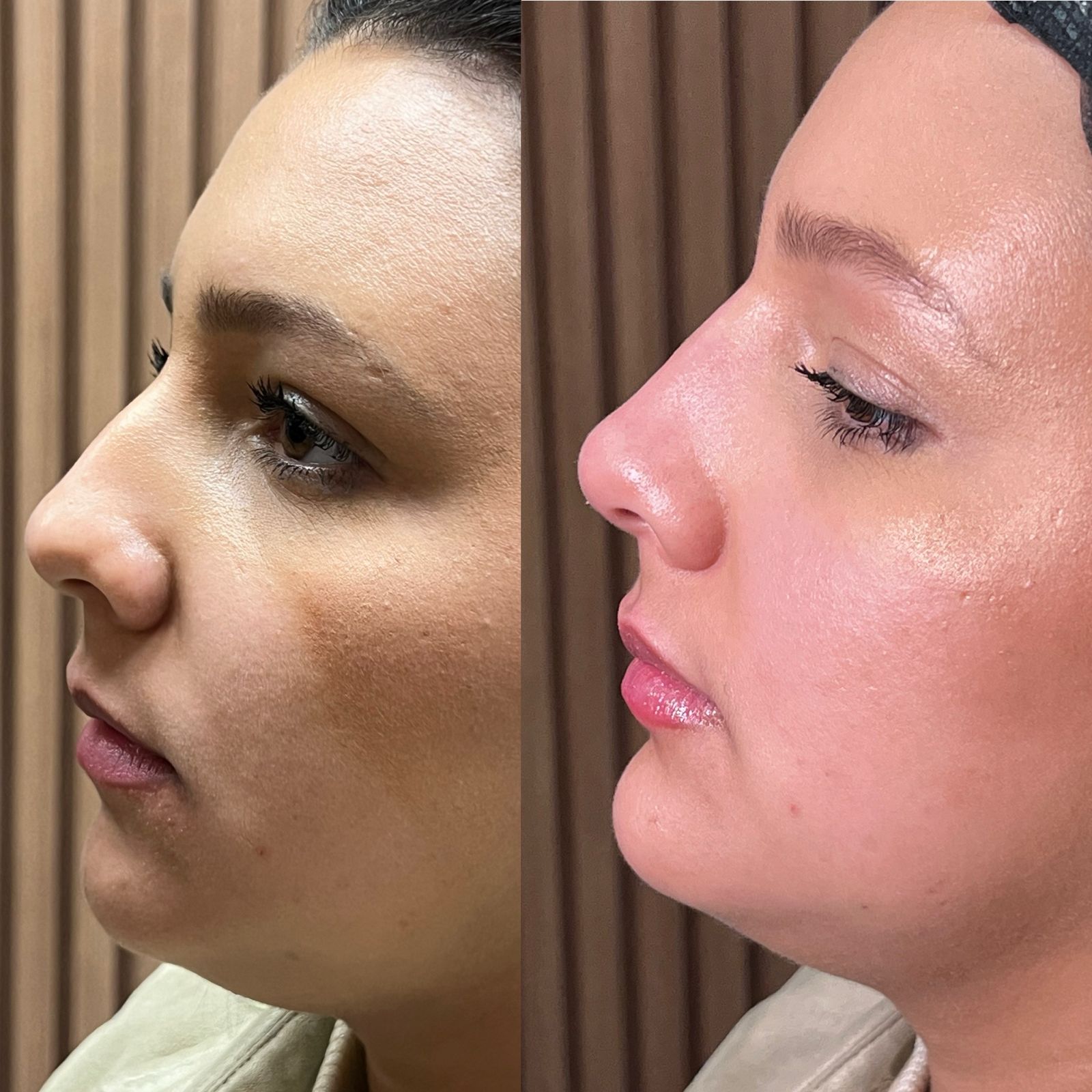 Antes e depois