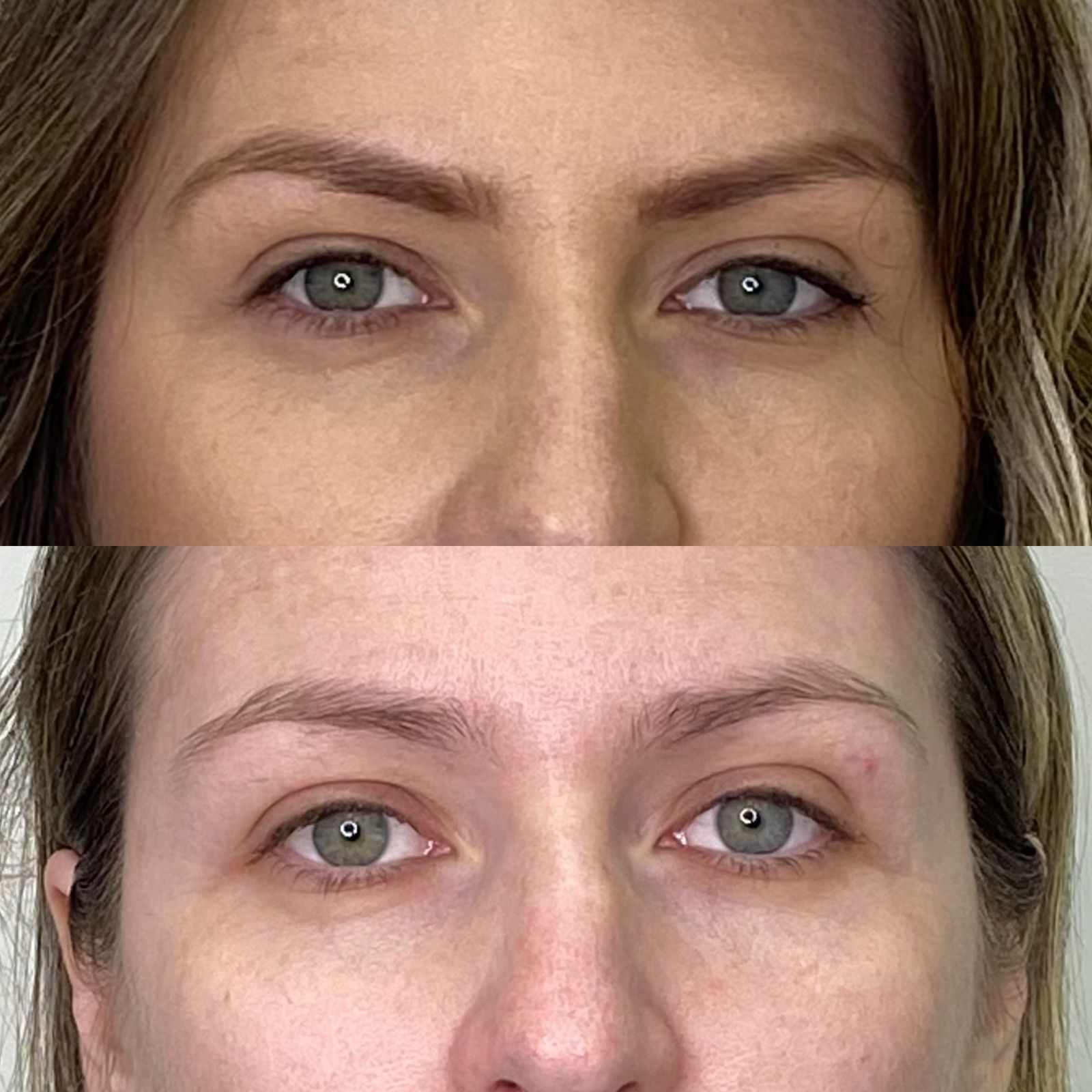 Antes e depois