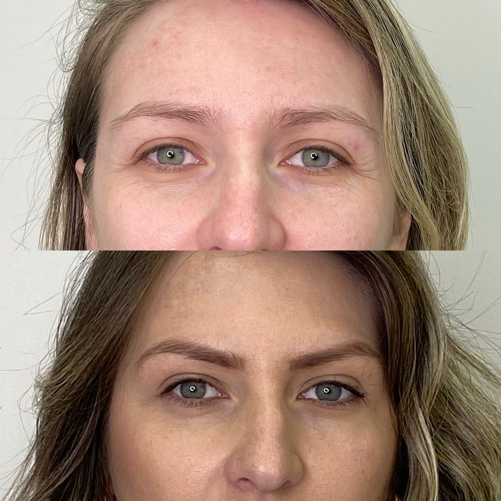 Antes e depois Bélla Natural